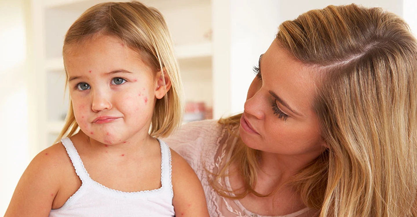 Atrium Health Floyd Pediatrician Concerned about Measles in U.S.