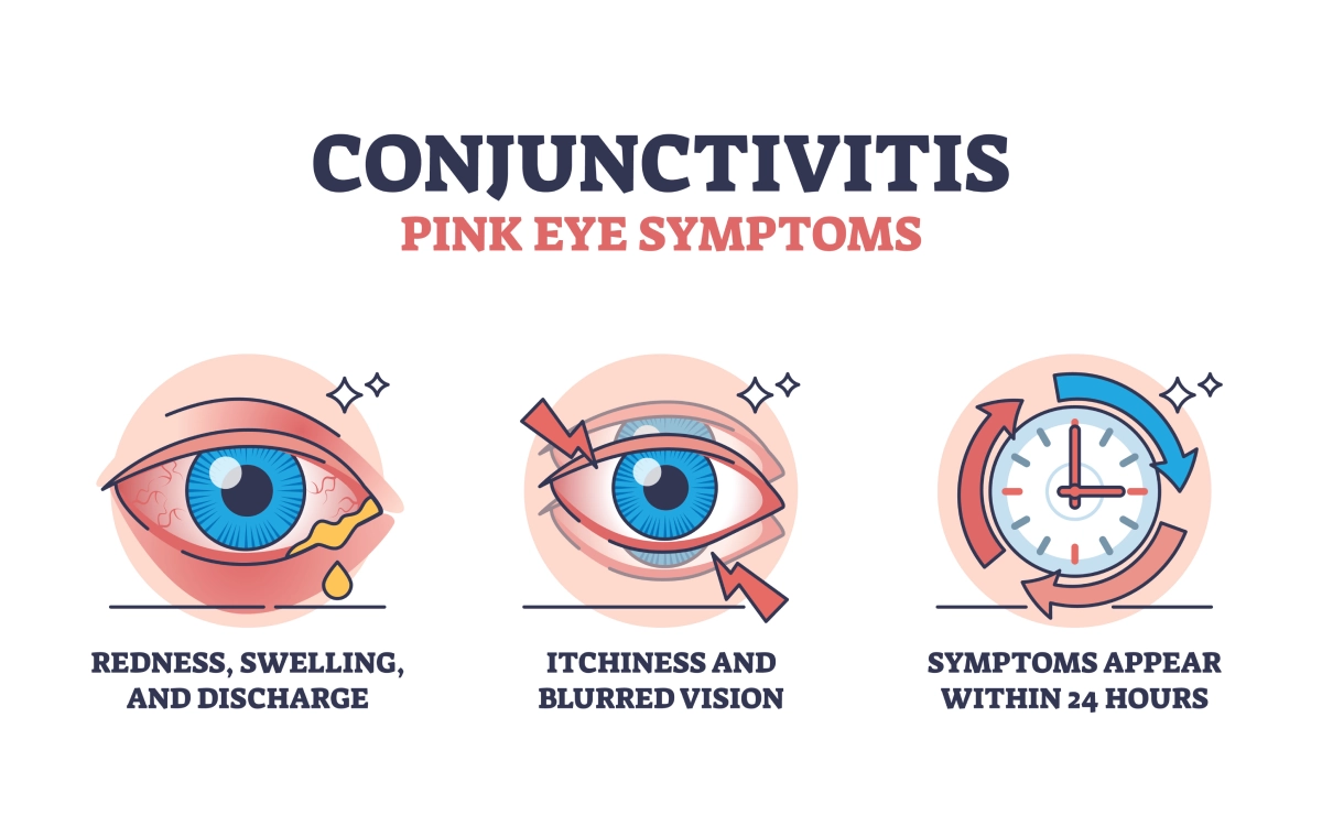 Image shows symptoms of pink eye